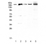 Western blot testing of 1) human PANC-1, 2) human MCF7, 3) human COLO320, 4) rat heart and 5) mouse brain lysate with PER1 antibody at 0.5ug/ml. Predicted molecular weight ~136 kDa, observed here at ~200 kDa.