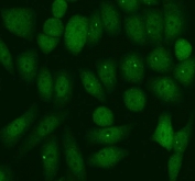 Western blot testing of 1) human PANC-1, 2) human MCF7, 3) human COLO320, 4) rat heart and 5) mouse brain lysate with PER1 antibody at 0.5ug/ml. Predicted molecular weight ~136 kDa, observed here at ~200 kDa.