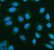 Immunofluorescent staining of FFPE human SiHa cells with Glucokinase antibody (green) and DAPI nuclear stain (blue). HIER: steam section in pH6 citrate buffer for 20 min.