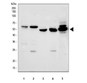 Western blot testing of 1) human SH-SY5Y, 2) human Jurkat, 3) rat liver, 4) rat RH35 and 5) mouse HEPA1/6 cell lysate with Glucokinase antibody at 0.5ug/ml. Predicted molecular weight ~52 kDa.