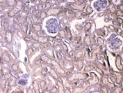 IHC testing of FFPE mouse kidney tissue with Vegf receptor 2 antibody at 1ug/ml. Required HIER: steam section in pH6 citrate buffer for 20 min and allow to cool prior to testing.