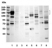 Western blot testing of mouse 1) heart, 2) thymus, 3) spleen, 4) kidney, 5) brain, 6) lung, 7) HEPA1-6 and 8) NIH 3T3 lysate with Vegf receptor 2 antibody. Predicted molecular weight: ~152 (immature), 180-200 kDa (intermediate) and 220-230 kDa (mature).