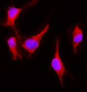 Immunofluorescent staining of FFPE human NIH 3T3 cells with Vegf receptor 2 antibody (red) and DAPI nuclear stain (blue). HIER: steam section in pH6 citrate buffer for 20 min.