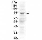 Western blot testing of mouse thymus lysate with MAP3K20 antibody at 0.5ug/ml. Predicted molecular weight ~91 kDa.