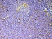 IHC testing of FFPE mouse thymus tissue with Cd59 antibody at 1ug/ml. Required HIER: steam section in pH6 citrate buffer for 20 min and allow to cool prior to testing.