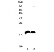Western blot testing of mouse kidney and 2) mouse brain lysate with Il-22 antibody at 0.5ug/ml. Observed molecular weight: 19~25 kDa depending on glycosylation level.