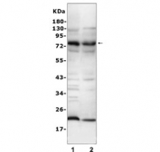 Western blot testing of mouse 1) liver and 2) lung tissue lysate with C9 antibody at 0.5ug/ml. Expected molecular weight: 65-70 kDa.