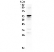 Western blot testing of human placental tissue lysate with C9 antibody at 0.5ug/ml. Expected molecular weight: 65-70 kDa.