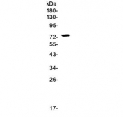 Western blot testing of human HepG2 cell lysate with IRAK1 antibody at 0.5ug/ml. Predicted molecular weight ~76 kDa.