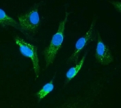 Immunofluorescent staining of FFPE human A549 cells with IRAK1 antibody (green) and DAPI nuclear stain (blue). HIER: steam section in pH6 citrate buffer for 20 min.