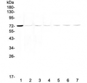 Western blot testing of human 1) HeLa, 2) MCF7, 3) COLO320, 4) HepG2, 5) rat stomach, 6) mouse stomach and 7) mouse heart lysate with Tec antibody at 0.5ug/ml. Predicted molecular weight ~73 kDa.