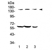 Western blot testing of human 1) COLO-320, 2) HepG2 and 3) A549 lysate with KCNH1 antibody at 0.5ug/ml. Predicted molecular weight ~111 kDa (may be observed larger than predicted due to glycosylation).