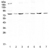 Western blot testing of human 1) HeLa, 2) MCF7, 3) HepG2, 4) SKOV3, 5) A549, 6) rat kidney and 7) mouse kidney lysate with MST1 antibody at 0.5ug/ml. Predicted molecular weight ~80 kDa.