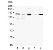 Western blot testing of 1) human K562, 2) human Raji, 3) rat testis, 4) rat brain and 5) mouse brain lysate with CD41 antibody at 0.5ug/ml. Expected molecular weight ~120 kDa (alpha chain) and ~23 kDa (beta chain).