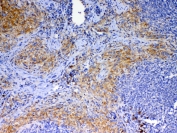 IHC testing of FFPE mouse spleen tissue with Cd40l antibody at 1ug/ml. Required HIER: steam section in pH6 citrate buffer for 20 min and allow to cool prior to testing.