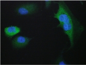 IF/ICC staining of FFPE human A549 cells with 14-3-3 sigma antibody (green) at 2ug/ml and DAPI nuclear stain (blue). HIER: boil tissue sections in pH6, 10mM citrate buffer, for 10-20 min and allow to cool before testing.