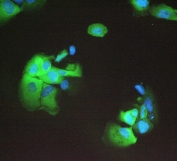 IF/ICC staining of FFPE human A431 cells with 14-3-3 sigma antibody (green) at 2ug/ml and DAPI nuclear stain (blue). HIER: boil tissue sections in pH6, 10mM citrate buffer, for 10-20 min and allow to cool before testing.