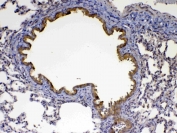 IHC testing of FFPE rat lung tissue with Factor D antibody at 1ug/ml. Required HIER: steam section in pH6 citrate buffer for 20 min and allow to cool prior to testing.