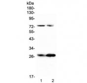 Western blot testing of rat 1) RH35 and 2) PC-12 cell lysate with Factor D antibody at 0.5ug/ml. Predicted molecular weight ~27 kDa.