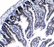 IHC testing of FFPE mouse small intestine tissue with CBX3 antibody at 1ug/ml. Required HIER: steam section in pH6 citrate buffer for 20 min and allow to cool prior to testing.