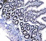IHC testing of FFPE rat small intestine tissue with CBX3 antibody at 1ug/ml. Required HIER: steam section in pH6 citrate buffer for 20 min and allow to cool prior to testing.