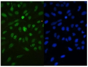 Immunofluorescent staining of FFPE human U-2 OS cells with CBX3 antibody (green) and DAPI (blue). HIER: boil tissue sections in pH6, 10mM citrate buffer, for 20 min and allow to cool before testing.