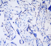 IHC testing of frozen human placental tissue with CBX3 antibody at 1ug/ml.