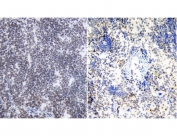 IHC testing of frozen mouse (left) and rat (right) spleen tissue with CBX3 antibody at 1ug/ml.