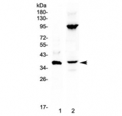 Western blot testing of 1) mouse NIH3T3 and 2) human A549 cell lysate with IL12 p40 antibody at 0.5ug/ml. Predicted molecular weight ~37 kDa, observed molecular weight ~40 kDa.