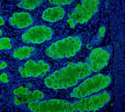 Immunofluorescent staining of FFPE human intestine with Mucin-2 antibody. HIER: boil tissue sections in pH6, 10mM citrate buffer, for 20 min and allow to cool before testing.