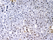 IHC testing of FFPE mouse liver tissue with VEGF Receptor 3 antibody at 1ug/ml. Required HIER: steam section in pH6 citrate buffer for 20 min and allow to cool prior to testing.