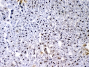 IHC testing of FFPE mouse liver tissue with VEGF Receptor 3 antibody at 1ug/ml. Required HIER: steam section in pH6 citrate buffer for 20 min and allow to cool prior to testing.