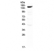 Western blot testing of rat liver lysate with VEGF Receptor 3 antibody at 0.5ug/ml. Predicted molecular weight ~153 kDa (long), ~147 kDa (short) and ~93 kDa (sVegfr3)