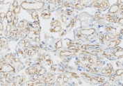 IHC testing of frozen human placental tissue with VEGF Receptor 3 antibody.