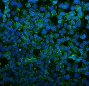 Immunofluorescent staining of FFPE human A431 cells with VEGF Receptor 3 antibody (green) at 2ug/ml and DAPI nuclear stain (blue). HIER: steam section in pH6 citrate buffer for 20 min.