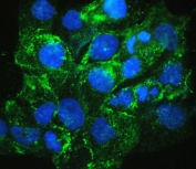 Immunofluorescent staining of FFPE human A431 cells with VEGF Receptor 3 antibody (green) at 2ug/ml and DAPI nuclear stain (blue). HIER: steam section in pH6 citrate buffer for 20 min.