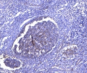 IHC testing of FFPE human tonsil tissue with CD81 antibody at 1ug/ml. Required HIER: steam section in pH6 citrate buffer for 20 min and allow to cool prior to testing.