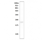 Western blot testing of mouse RAW264.7 cell lysate with CD81 antibody. Expected molecular weight: 22-26 kDa.