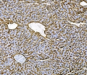 IHC staining of FFPE mouse spleen with Cd81 antibody. HIER: boil tissue sections in pH8 EDTA buffer for 20 min and allow to cool before testing.