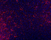 Immunofluorescent staining of FFPE mouse liver tissue with Cd81 antibody (red) and DAPI nuclear stain (blue). HIER: steam section in pH8 EDTA buffer for 20 min.