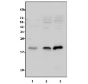 Western blot testing of mouse 1) thymus, 2) SP2/0 and 3) NIH 3T3 lysate with Cd81 antibody. Predicted molecular weight: 22-26 kDa.