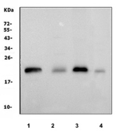 Western blot testing of 1) rat brain, 2) mouse ovary, 3) mouse brain and 4) mouse NIH 3T3 cell lysate with Cd81 antibody. Predicted molecular weight: 22-26 kDa.