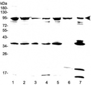 Western blot testing of human 1) HeLa, 2) 293T, 3) SKOV3, 4) A549, 5) MCF7, 6) placenta and 7) PANC-1 lysate with FES antibody at 0.5ug/ml. Predicted molecular weight ~93 kDa.