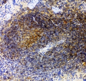 IHC staining of FFPE mouse spleen with GRK2 antibody. HIER: boil tissue sections in pH6, 10mM citrate buffer, for 20 min and allow to cool before testing.