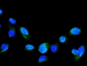 Immunofluorescent staining of FFPE human U-2 OS cells with GRK2 antibody (green) and DAPI nuclear stain (blue). HIER: steam section in pH6 citrate buffer for 20 min.