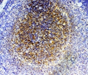 IHC staining of FFPE rat spleen with GRK2 antibody. HIER: boil tissue sections in pH6, 10mM citrate buffer, for 20 min and allow to cool before testing.