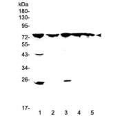 Western blot testing of 1) rat spleen, 2) rat stomach, 3) mouse lung, 4) mouse liver and 5) mouse pancreas lysate wtih GRK2 antibody at 0.5ug/ml. Predicted molecular weight ~79 kDa.