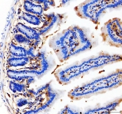 IHC staining of FFPE mouse colon tissue with CD31 antibody. HIER: boil tissue sections in pH8 EDTA for 20 min and allow to cool before testing.