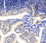 Western blot testing of mouse 1) ovary, 2) stomach and 3) kidney lysate with CD31 antibody at 0.5ug/ml. Expected molecular weight: 83-130 kDa depending on level of glycosylation.