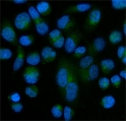 Immunofluorescent staining of FFPE human PC-3 cells with SOD3 antibody (green) and DAPI nuclear stain (blue). HIER: steam section in pH6 citrate buffer for 20 min.